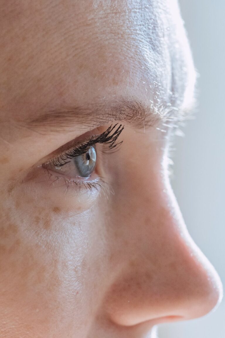 Naši zkušení lékaři a lékařky aplikují botox i do očního okolí při zachování maximální přirozenosti vaší tváře