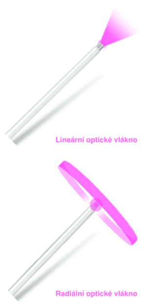 Lineární a radiální optická vlákna pro metodu Endolift